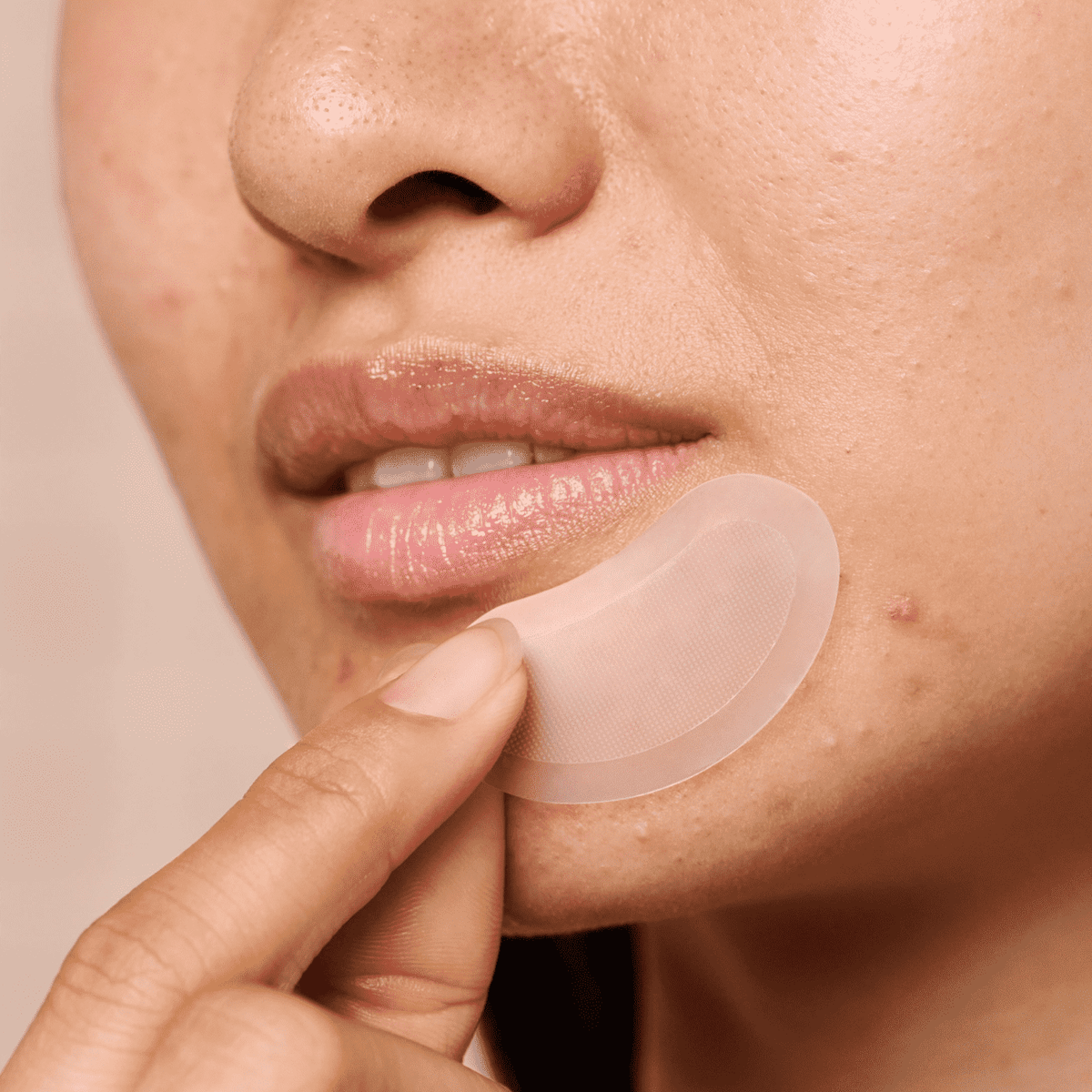 Mighty Parche™ for XL Early-Stage Blemishes — Hero Cosmetics