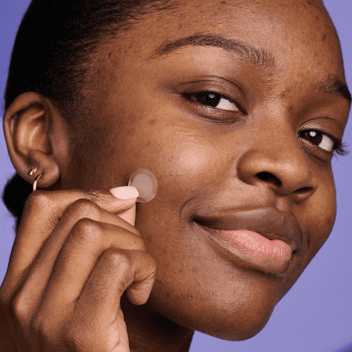 Mighty Parche™ for Dark Spots — Hero Cosmetics