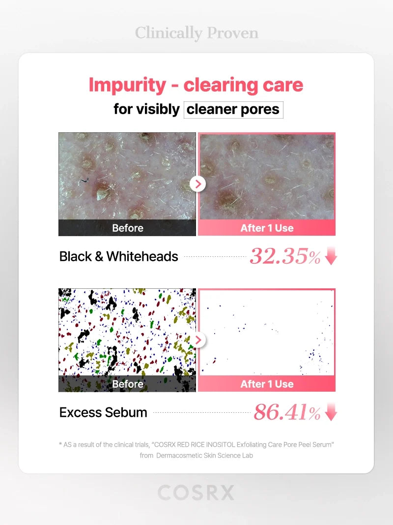 COSRX RED RICE INOSITOL Exfoliante Care Pore Wash-Off Peel Sérum