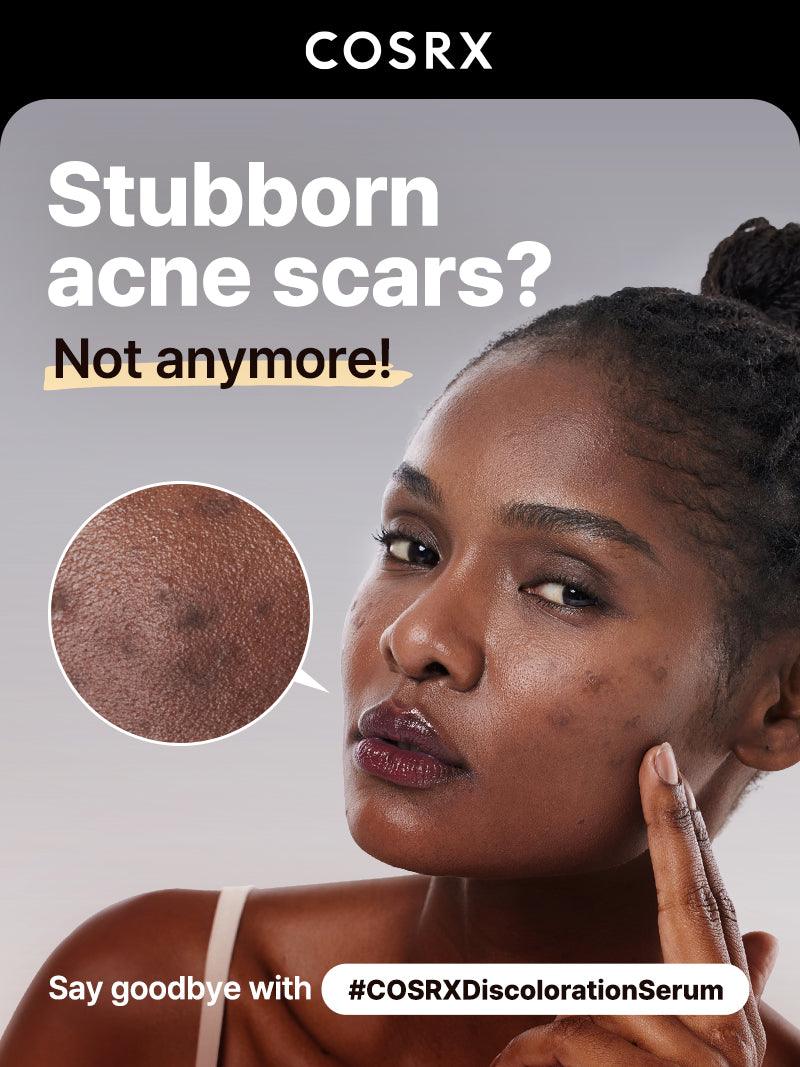 The Alpha-Arbutin 2 Discoloration Care Sérum — COSRX