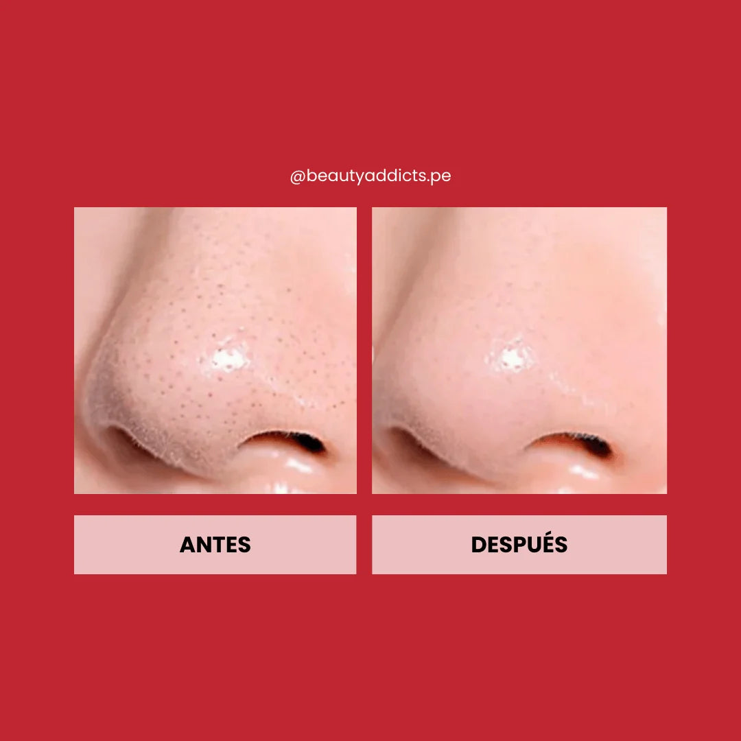 Calamine Pore Control Cleansing Oil — TOCOBO