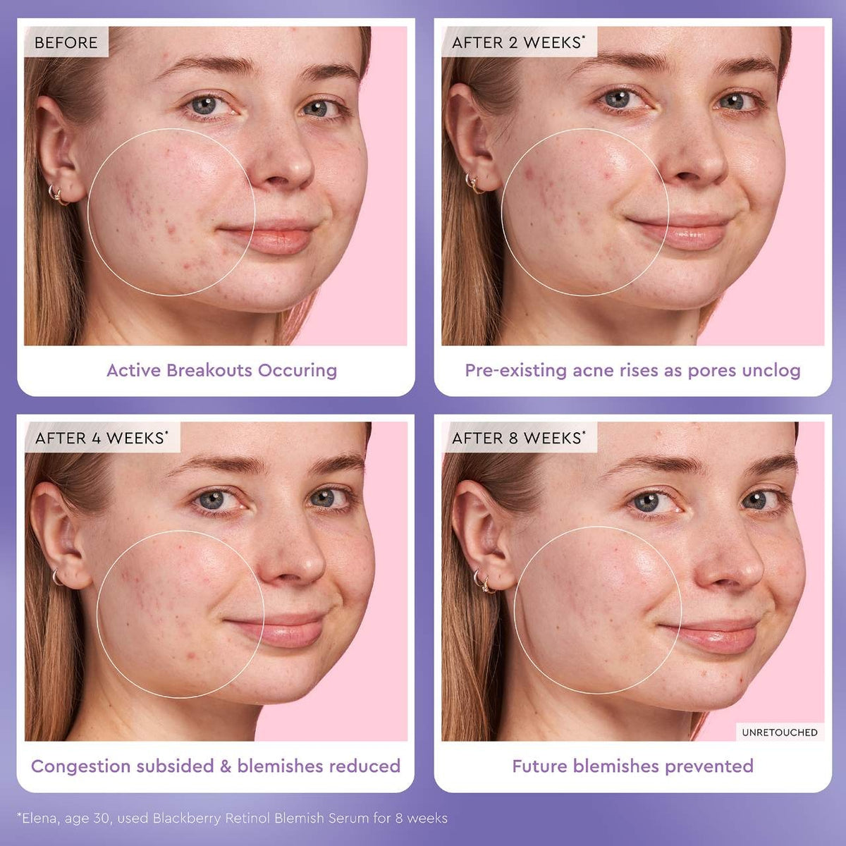 Sérum Blackberry Retinol Blemish — Glow Recipe