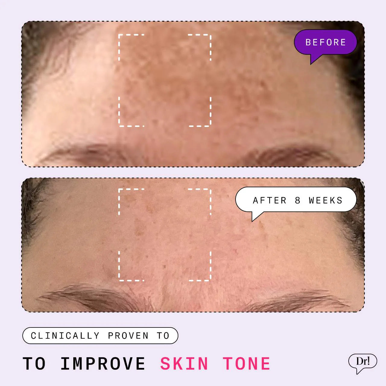 Major Fade Hyper Serum Tratamiento Manchas + Hiperpigmentación con Niacinamida y Glicerina — Dr. Idriss