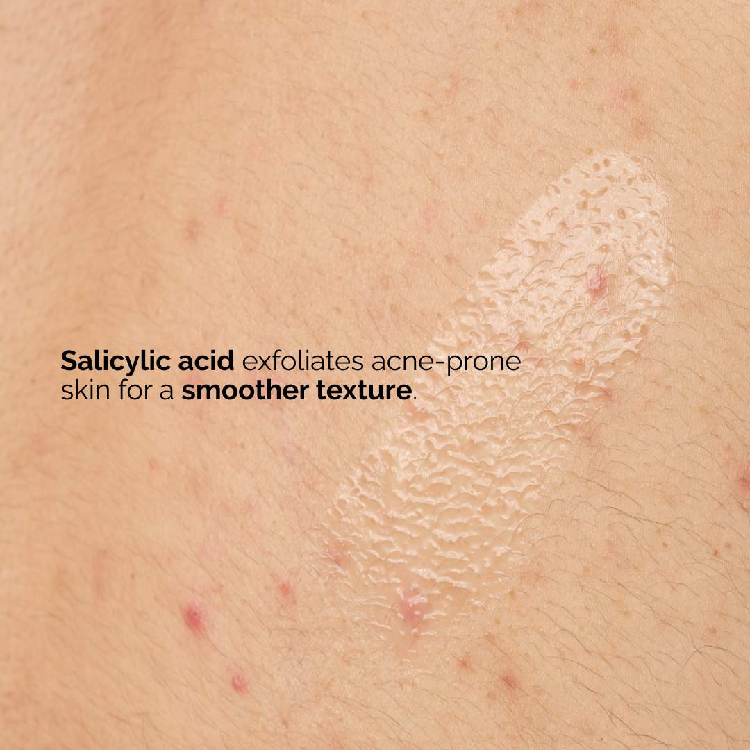 Tratamiento exfoliante de suero corporal con ácido salicílico al 0,5% para el acné — The Ordinary