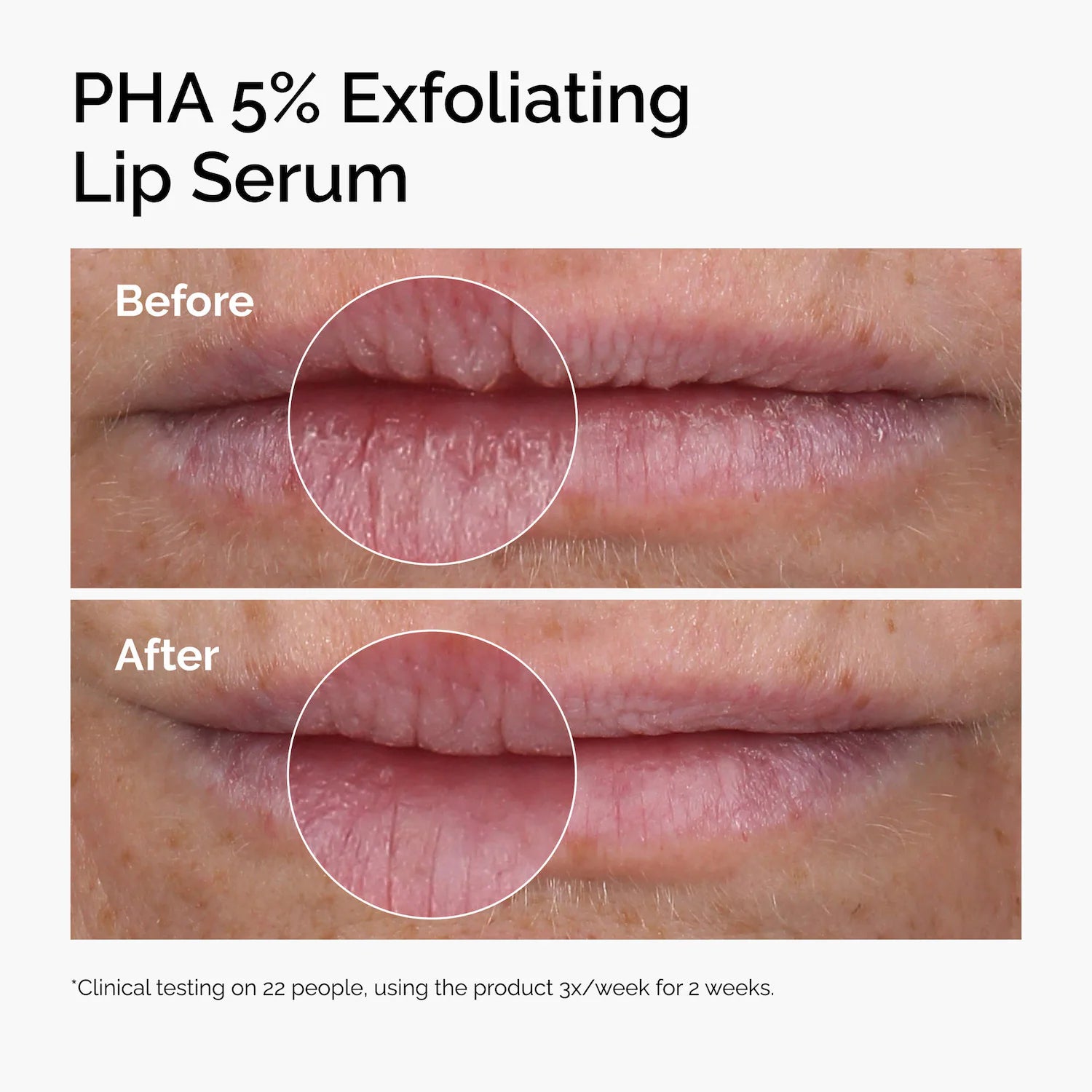 Suero labial exfoliante PHA 5% — The Ordinary