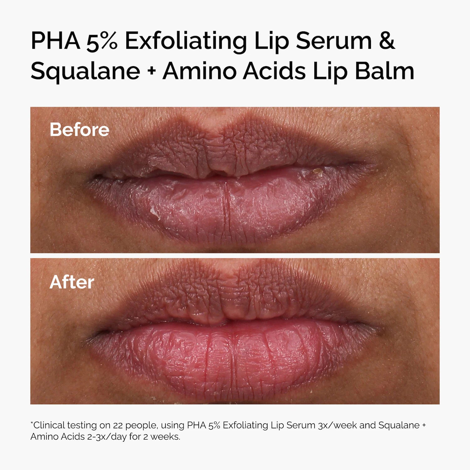 Suero labial exfoliante PHA 5% — The Ordinary