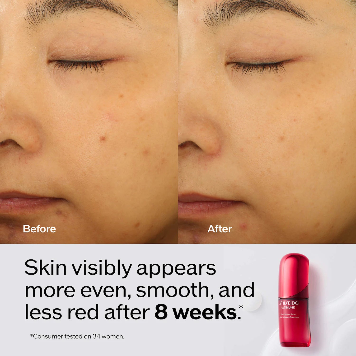 Suero de infusión Ultimune Power para luminosidad y arrugas — Shiseido