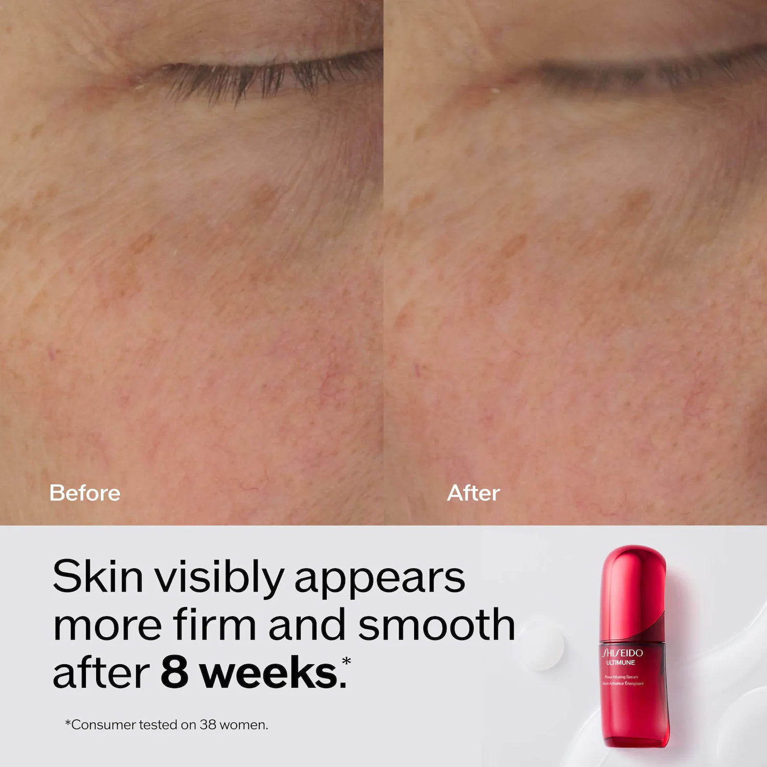 Suero de infusión Ultimune Power para luminosidad y arrugas — Shiseido