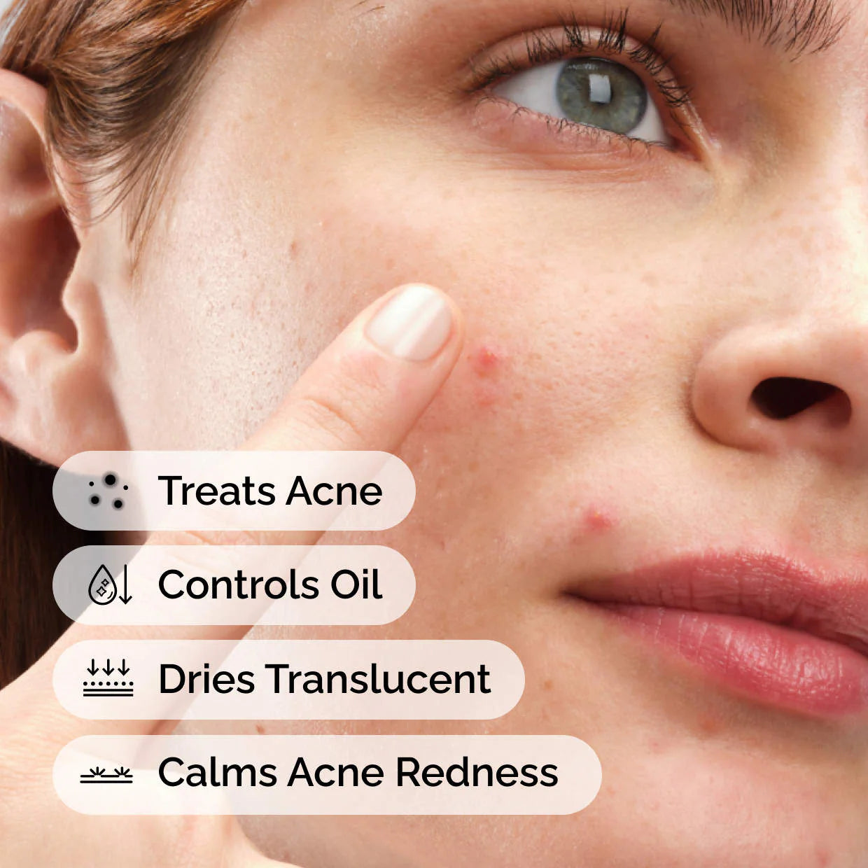 Tratamiento concentrado de azufre en polvo a crema para las manchas del acné al 10% — The Ordinary