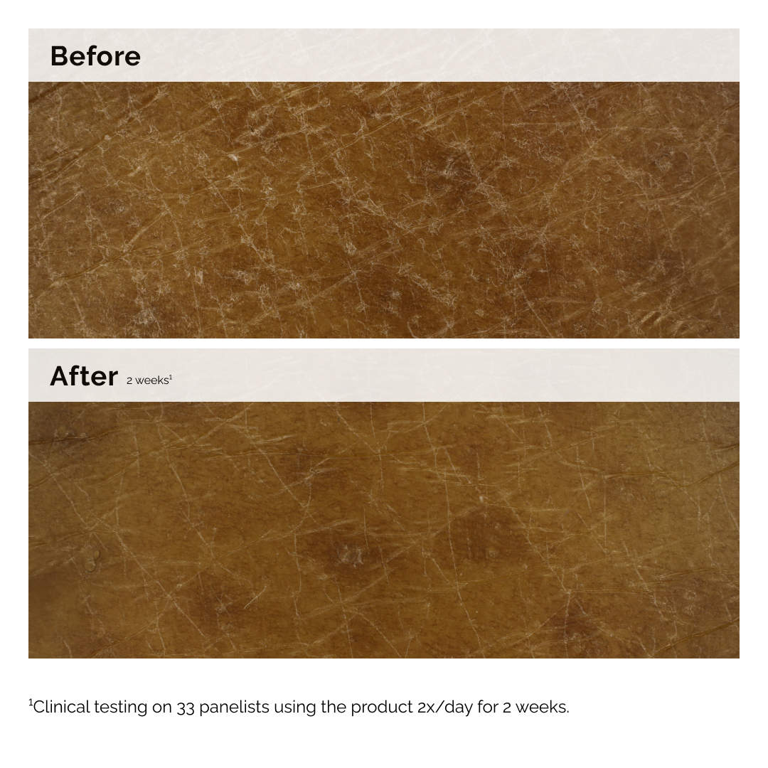 Factores Hidratantes Naturales + Loción Corporal de Inulina — The Ordinary